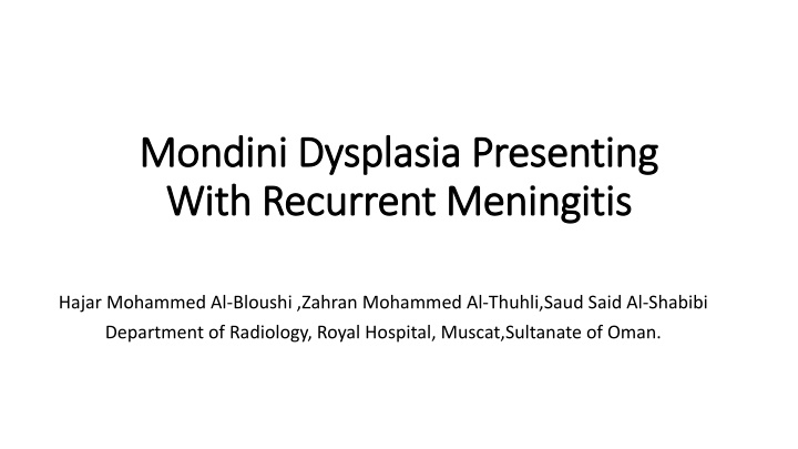 mondini dysplasia presenting mondini dysplasia n.w