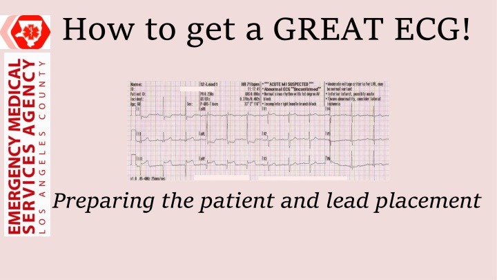 how to get a great ecg n.w