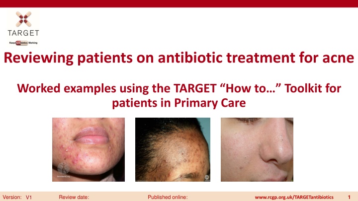 Reviewing patients on antibiotic treatment for acne