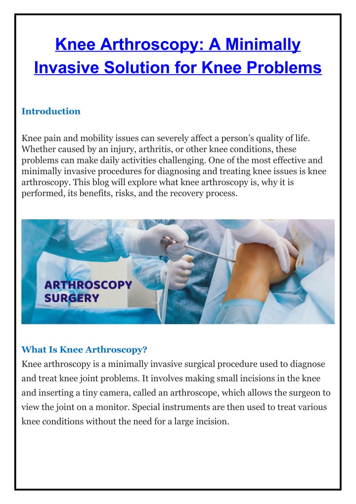 knee arthroscopy a minimally invasive solution n.w