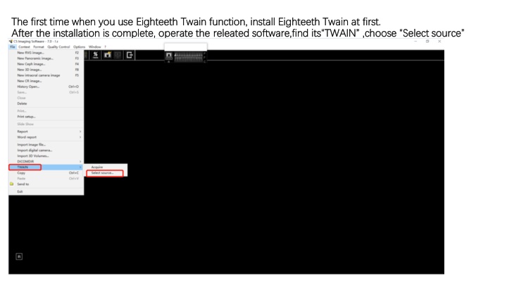 How to Use Eighteeth TWAIN Function and NanoPix Sensor
