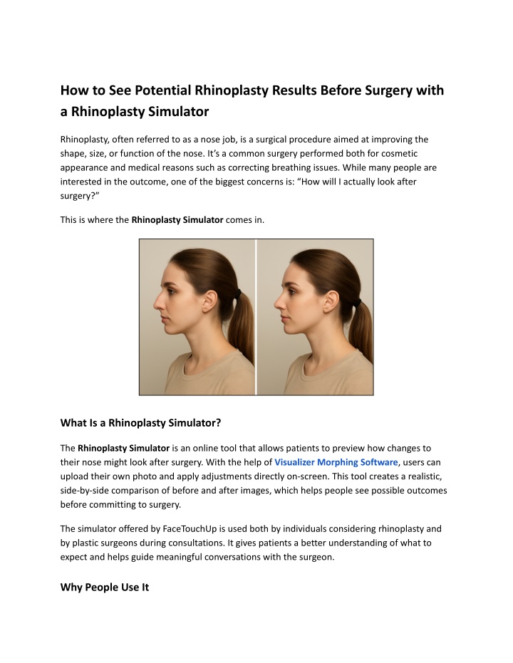 how to see potential rhinoplasty results before n.w