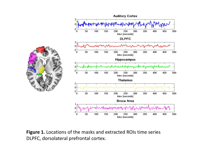 figure 1 locations of the masks and extracted n.w