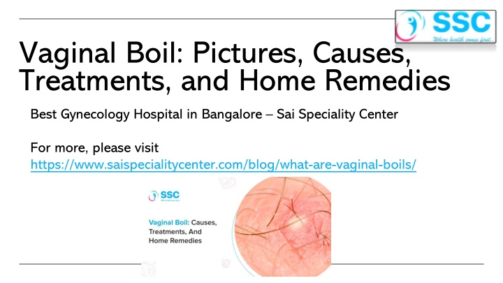 Vaginal Boil Pictures, Causes, Treatments, and Home Remedies - Sai Speciality