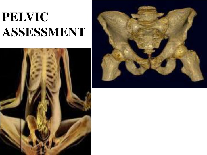pelvic assessment n.w