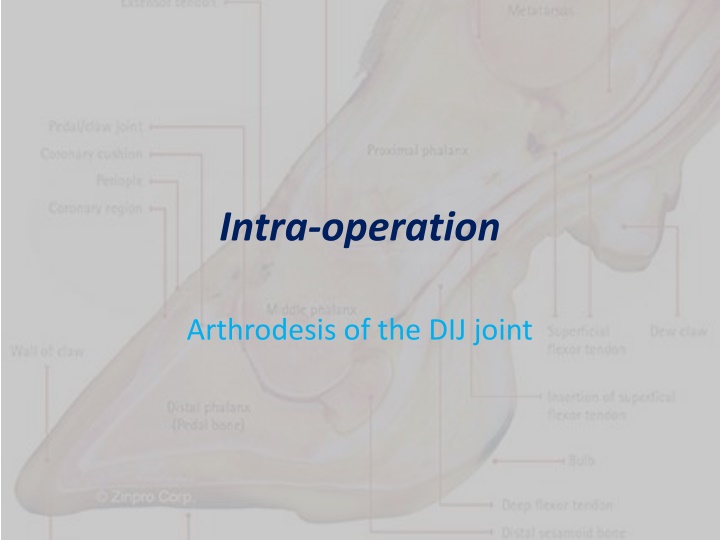 intra operation n.w
