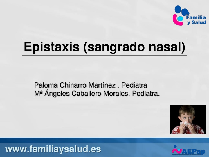 epistaxis sangrado nasal n.w