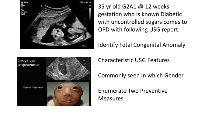 35 yr old g2a1 @ 12 weeks gestation who is known n.w