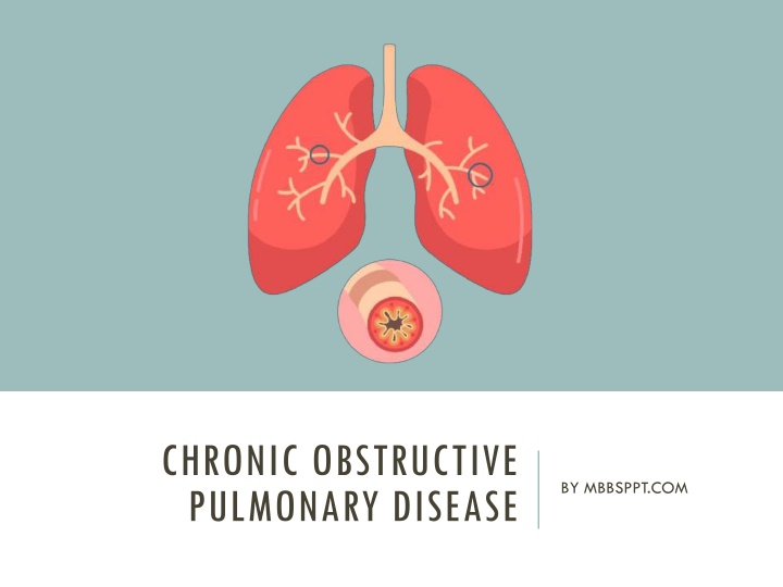 chronic obstructive pulmonary disease n.w