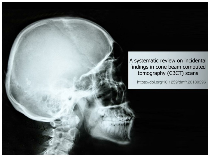 Incidental Findings in Cone Beam Computed Tomography Scans: A Review