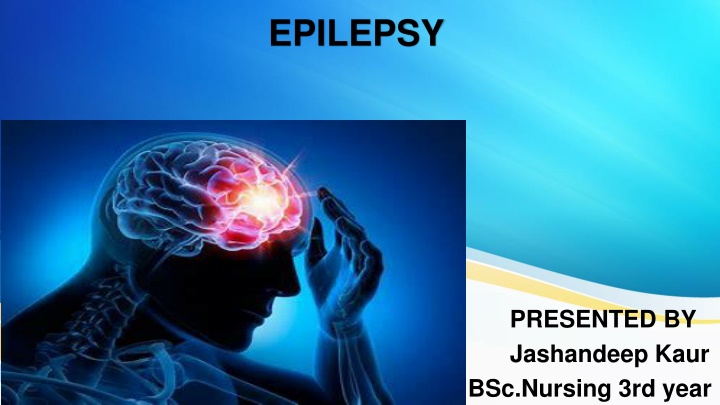 epilepsy n.w