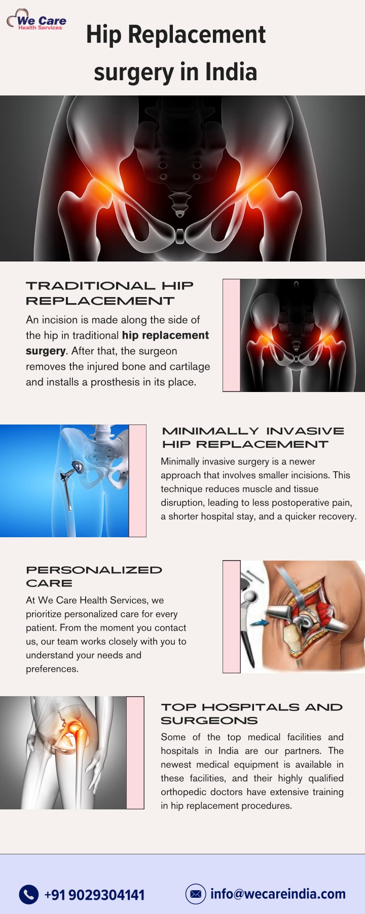 hip replacement surgery in india n.w