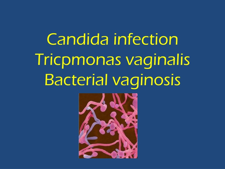 candida infection tricpmonas vaginalis bacterial n.w