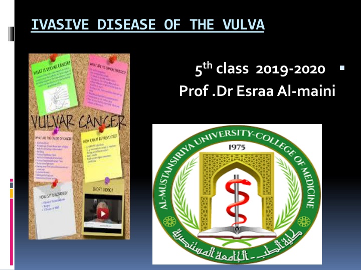 ivasive disease of the vulva n.w