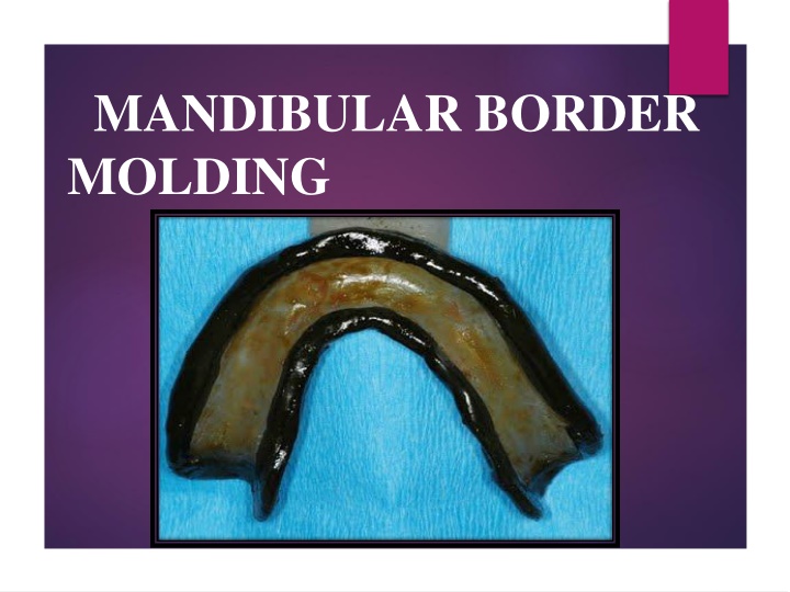mandibular border molding n.w