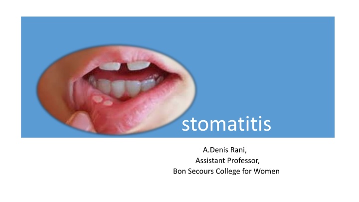 stomatitis n.w
