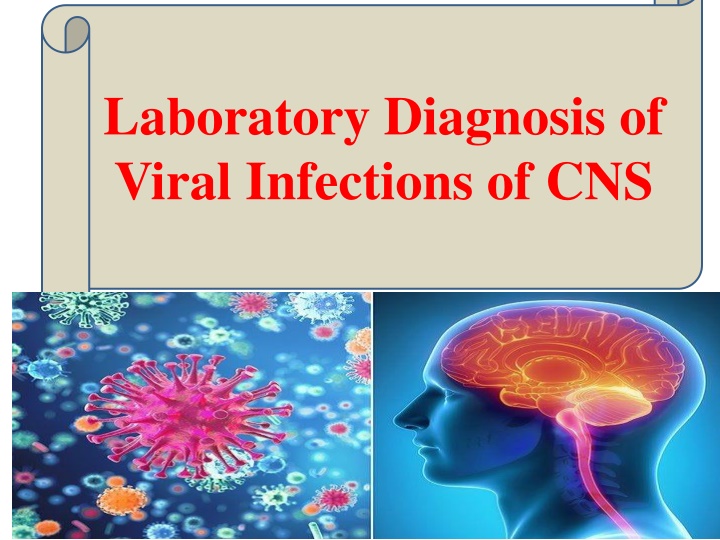 laboratory diagnosis of viral infections of cns n.w