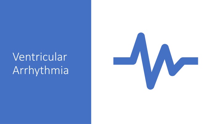 Overview of Ventricular Arrhythmia and Management