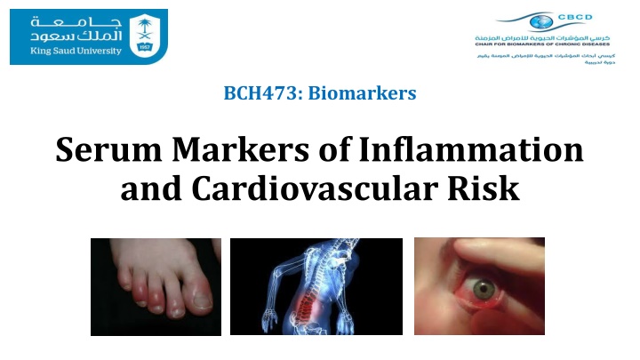 Serum Markers of Inflammation and Cardiovascular Risk