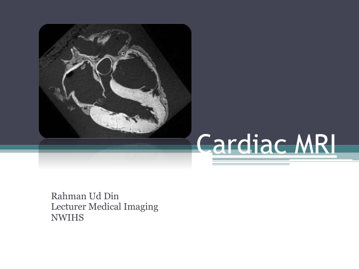 cardiac mri n.w