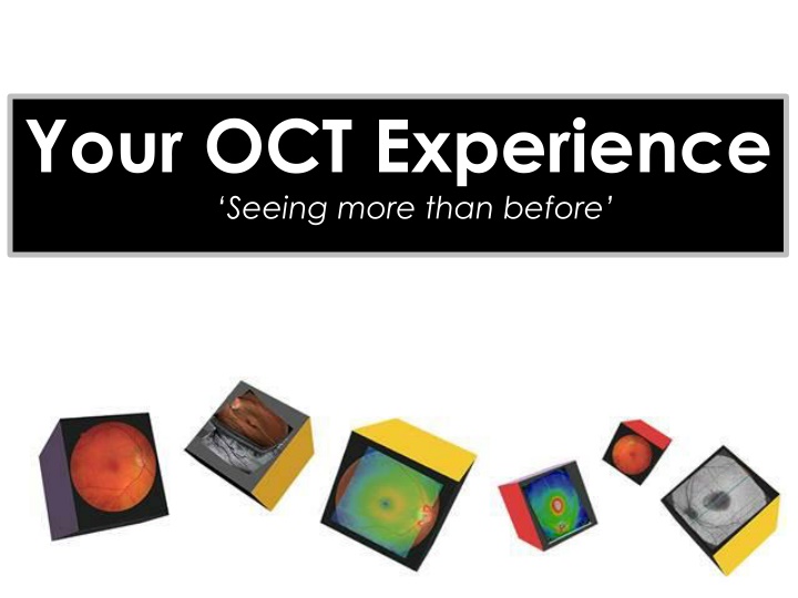your oct experience seeing more than before n.w