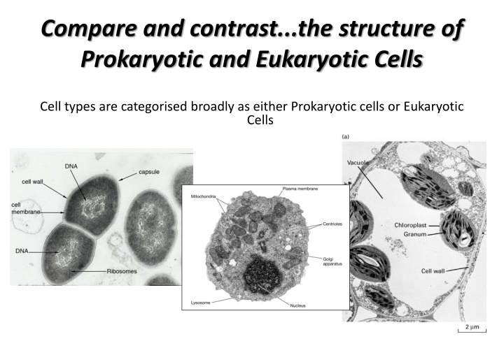 compare and contrast the structure of prokaryotic n.w
