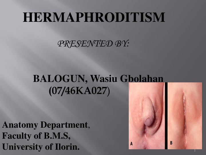 hermaphroditism n.w