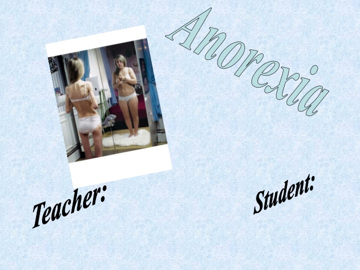 anorexia n.w