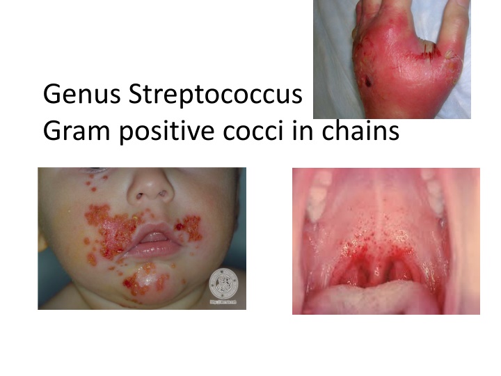 genus streptococcus gram positive cocci in chains n.w