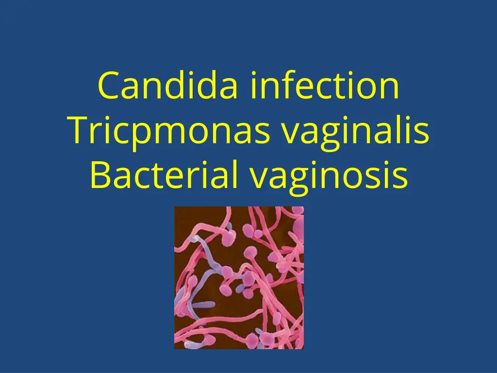 candida infection tricpmonas vaginalis bacterial n.w