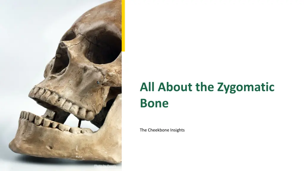 all about the zygomatic bone n.w