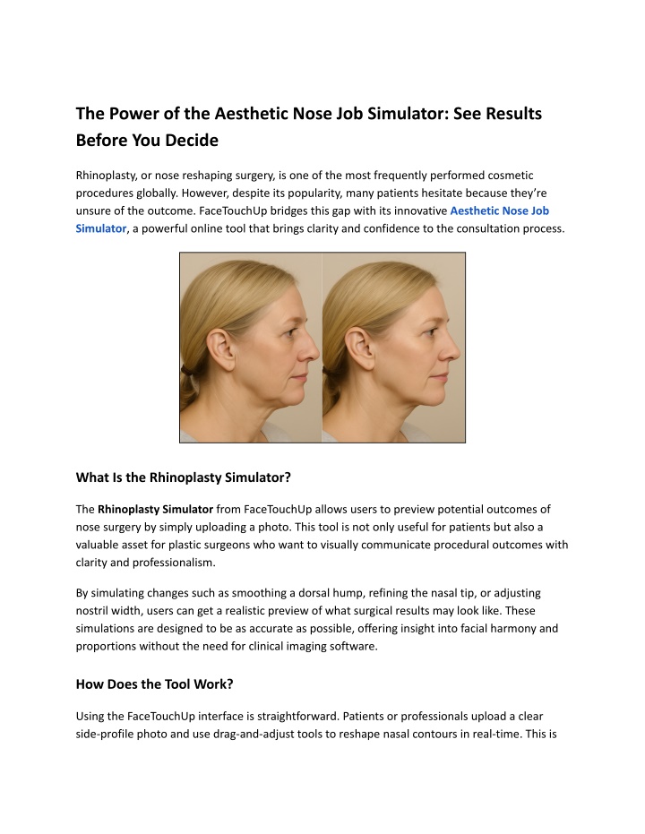the power of the aesthetic nose job simulator n.w