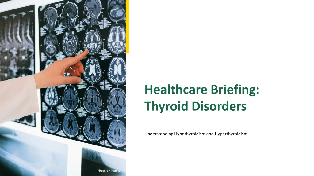 healthcare briefing thyroid disorders n.w