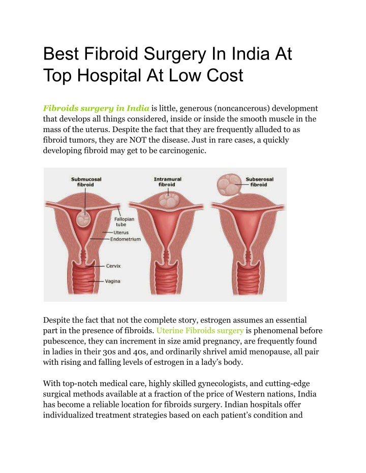 best fibroid surgery in india at top hospital n.w