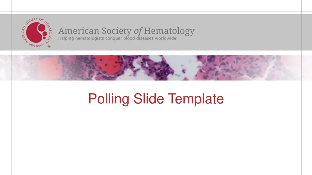 polling slide template n.w