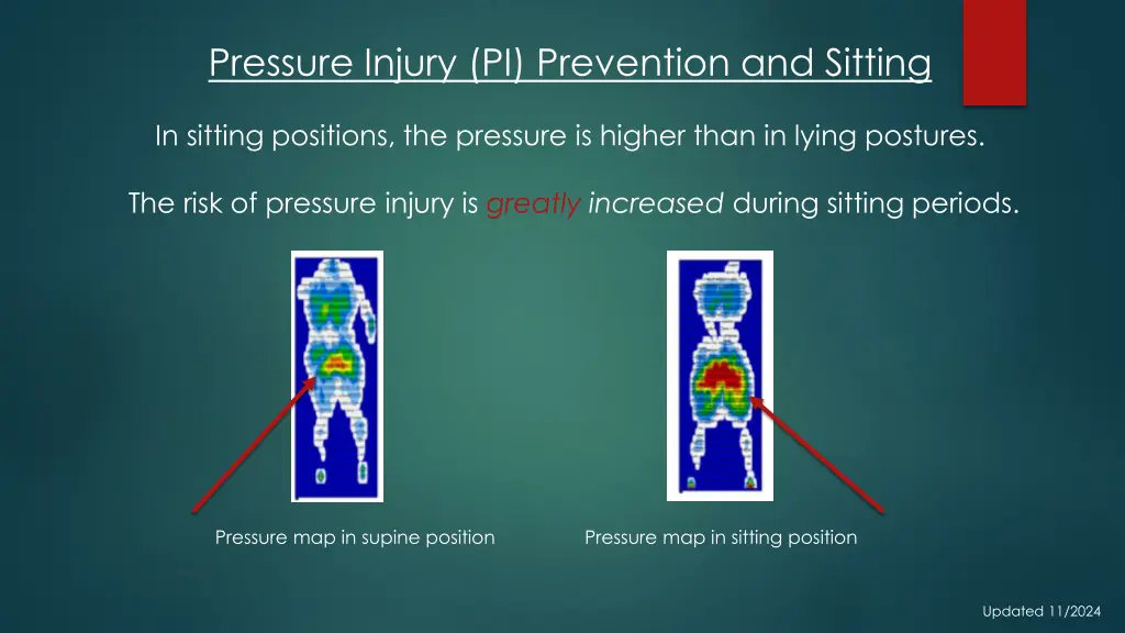 pressure injury pi prevention and sitting n.w