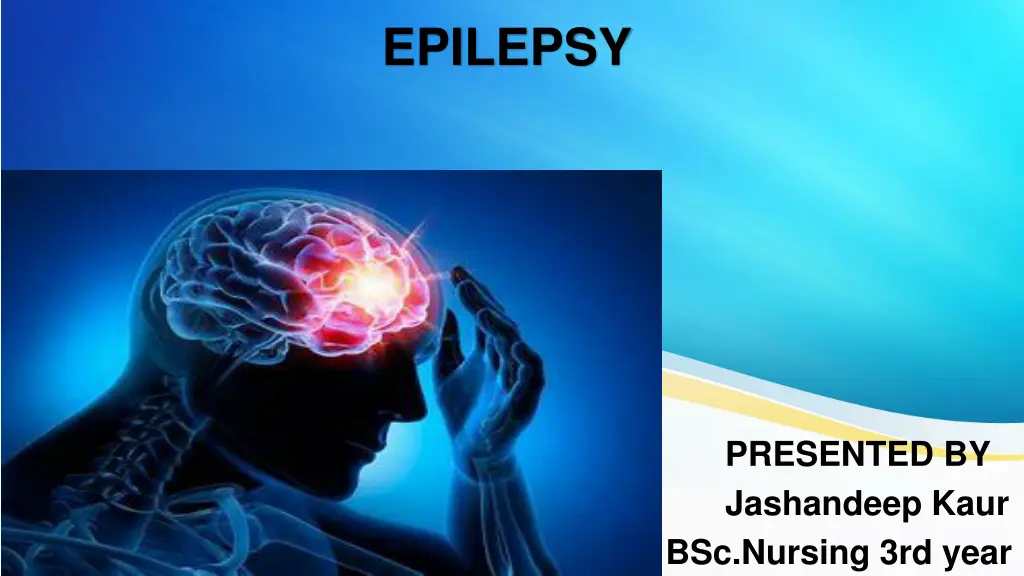 epilepsy n.w