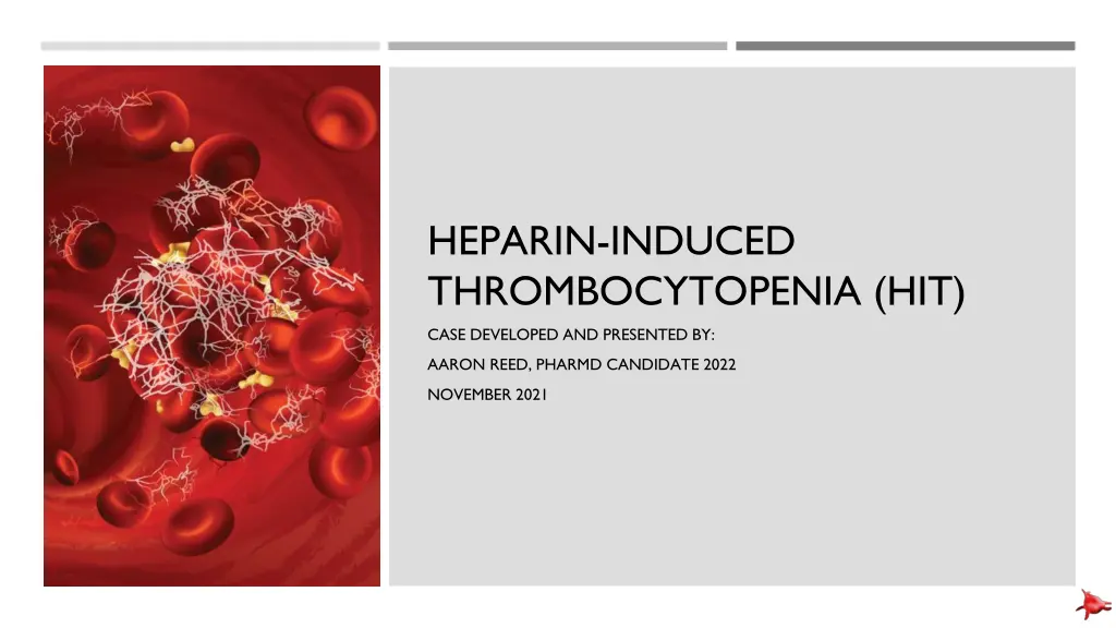 heparin induced thrombocytopenia hit case n.w