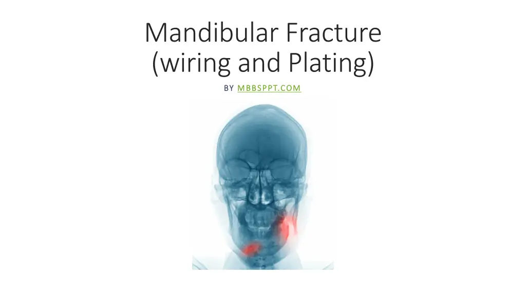 mandibular fracture wiring and plating n.w