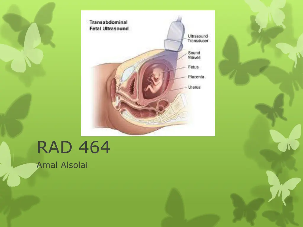 rad 464 amal alsolai n.w