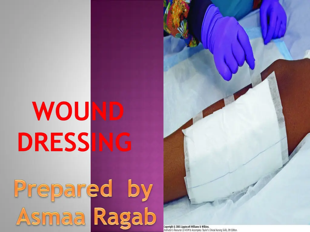 wound dressing n.w