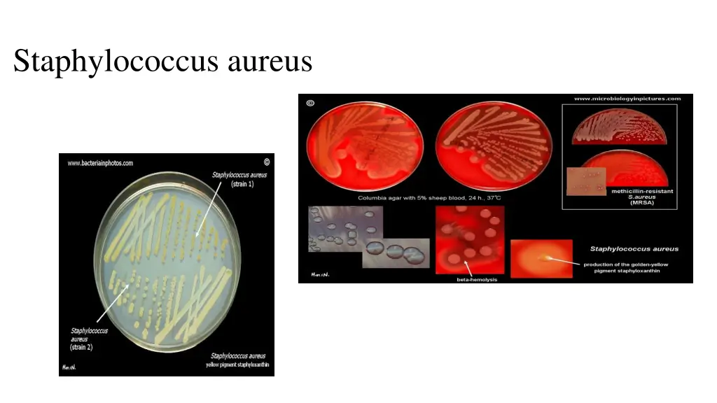 staphylococcus aureus n.w