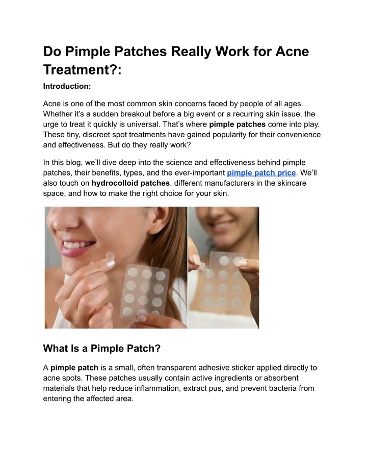 do pimple patches really work for acne treatment n.w