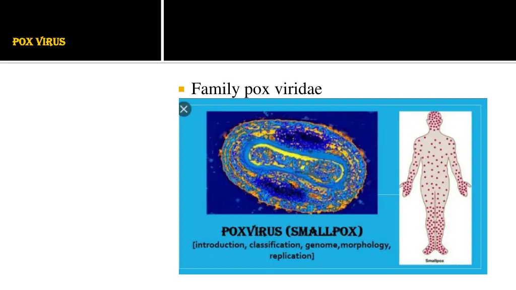 pox virus pox virus n.w