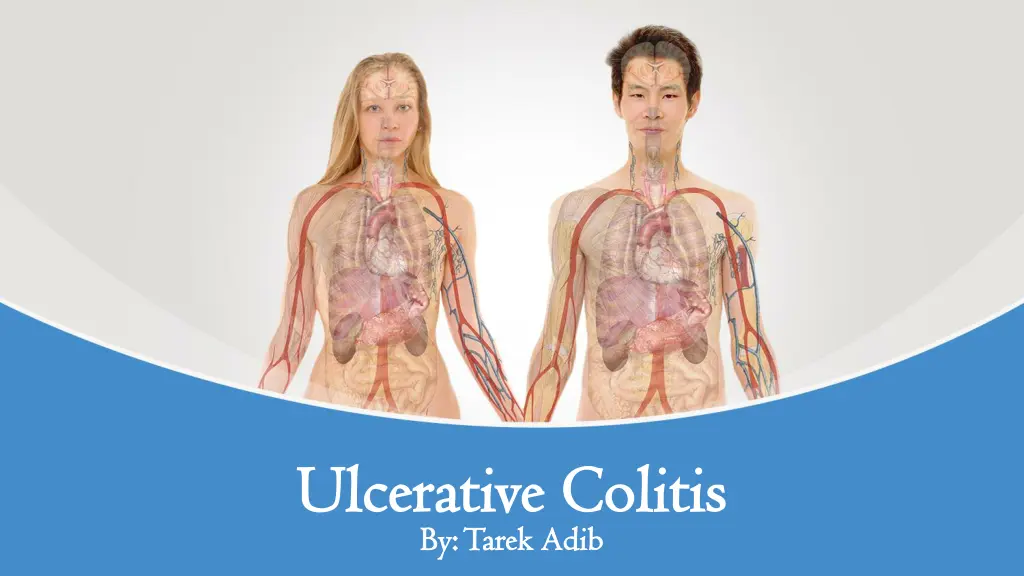 ulcerative colitis ulcerative colitis n.w