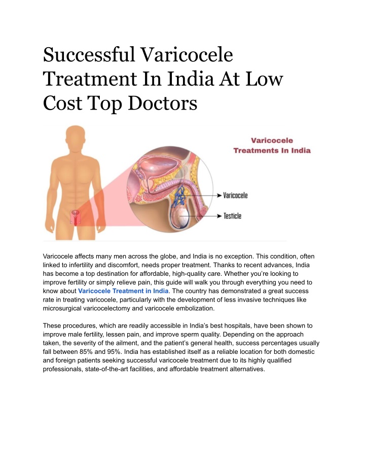 successful varicocele treatment in india n.w