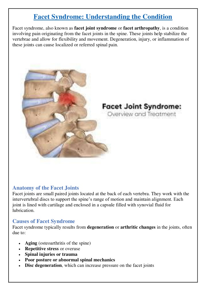 facet syndrome understanding the condition n.w