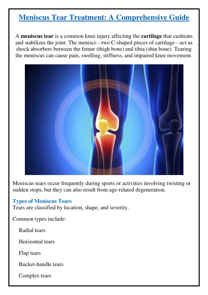 meniscus tear treatment a comprehensive guide n.w