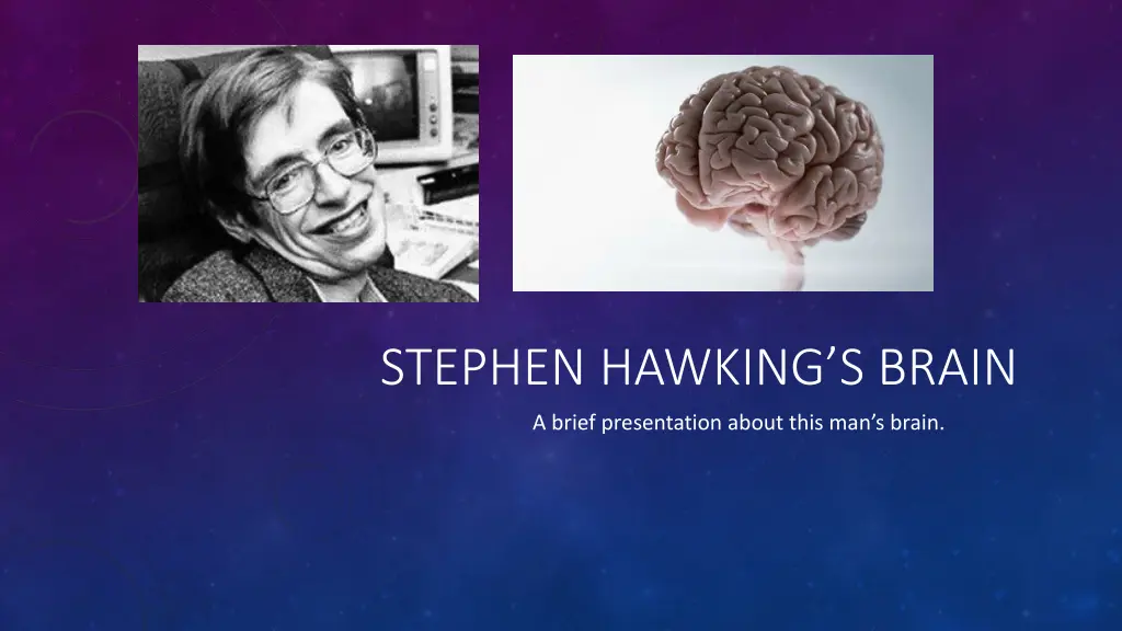 stephen hawking s brain n.w