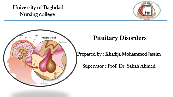 Pituitary Disorders